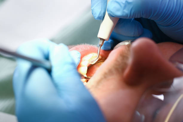 Best After-Hours Dental Care in Fussels Corner, FL
