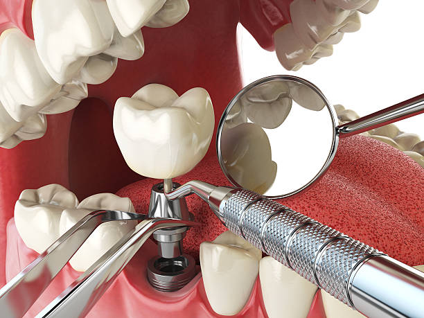 Best Urgent Dental Care for Toothaches in Fussels Corner, FL